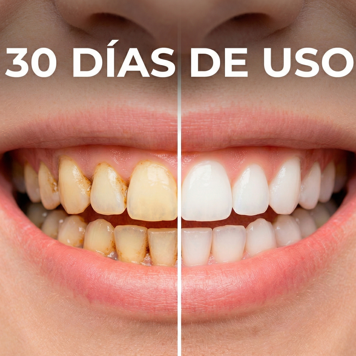 RenovaSmile™ | Cepillo Ultrasónico Automático 360°